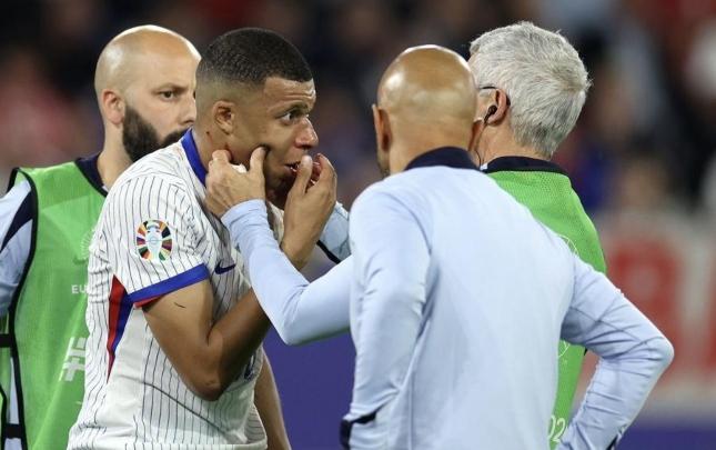 The latest condition of Mbappe who broke his nose has been announced
