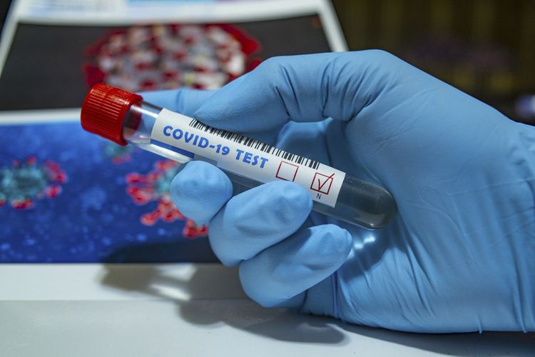  people infected with coronavirus in Azerbaijan  Special news