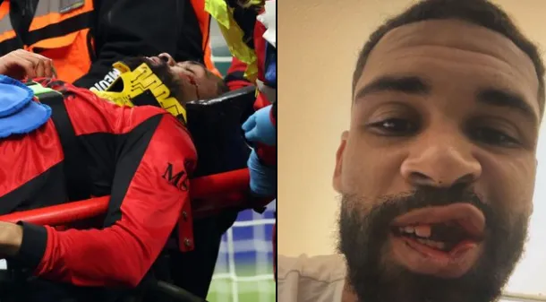 Ruben LoftusÇik ciddi üz travması aldı   həftəlik bərpa müddəti keçəcək